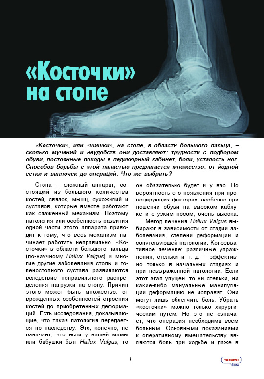 обуви, постоянные походы в