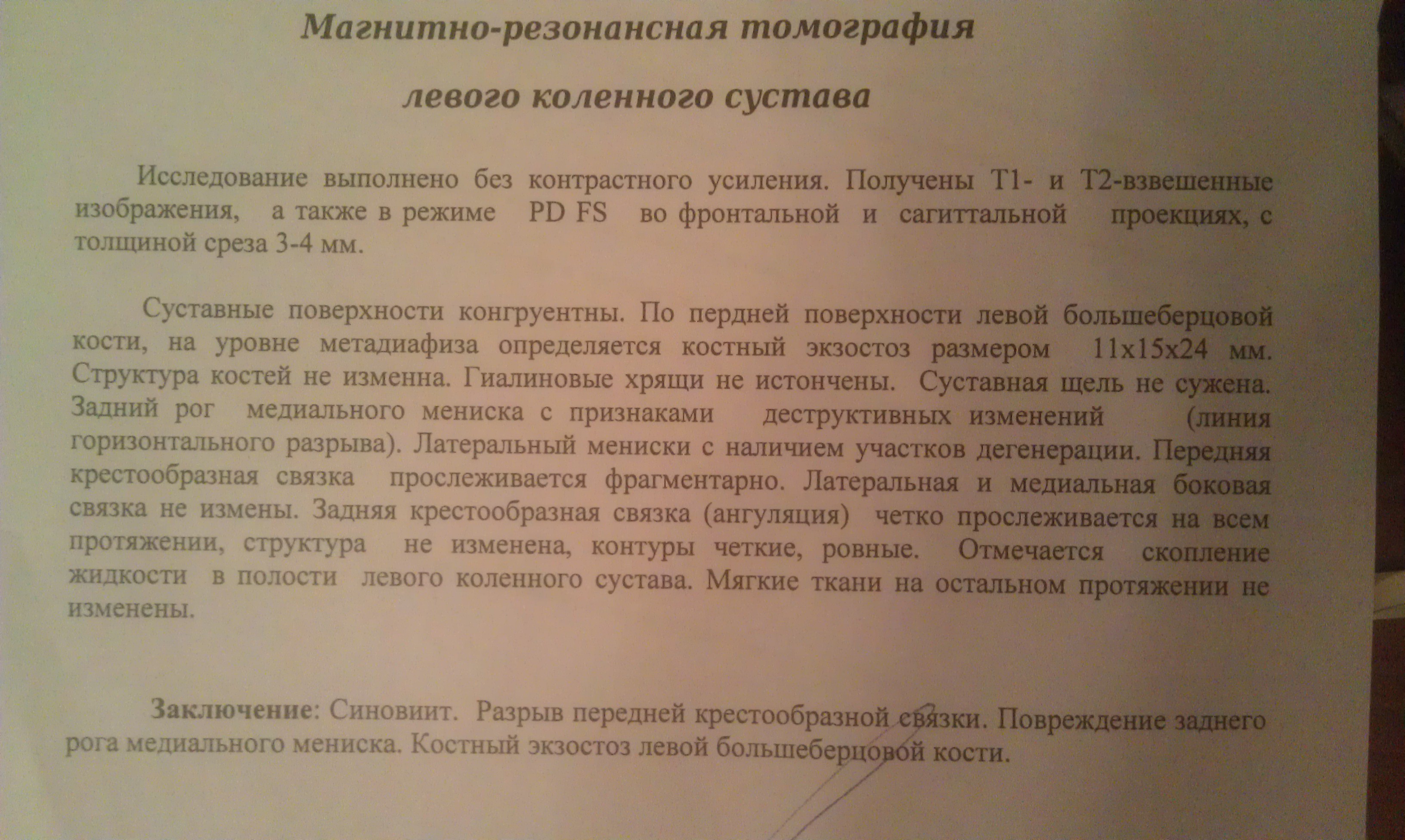 Описание узи сустава Описание узи сустава