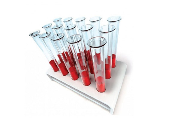 Расшифровываем клинический анализ крови
