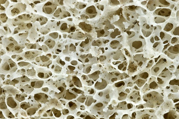 Денситометрия – исследование плотности костной ткани