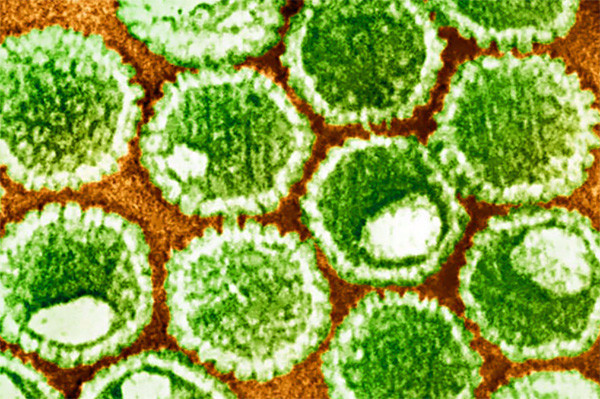 Herpes simplex virus – что это?