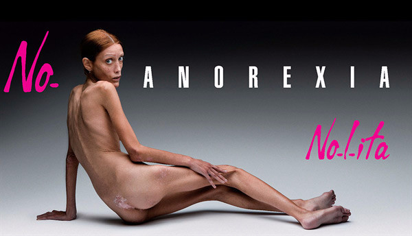 Расстройство пищевого поведения: анорексия