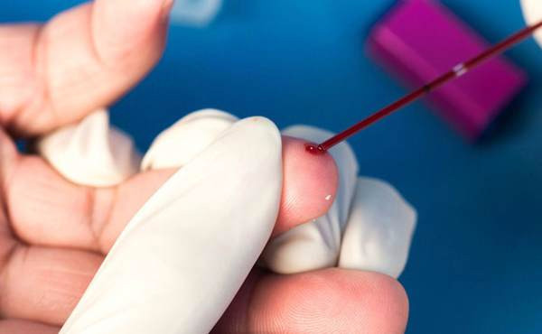 Почему кровь на анализ берут из безымянного пальца