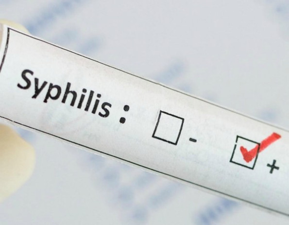 Положительный анализ на сифилис