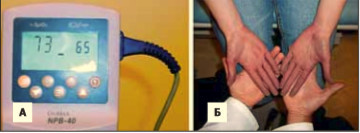 Фото 5.  Показатели пульса и сатурации кислорода на пульсоксиметре (А). Объективное отражение тканевой гипоксемии при осмотре (Б)