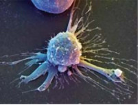 Фото 3. Электронно-микроскопическое изображение стволовой клетки