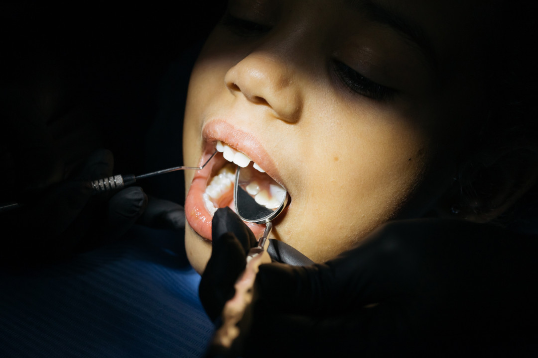 Седация в детской стоматологи – помощь врачу или риск для здоровья?