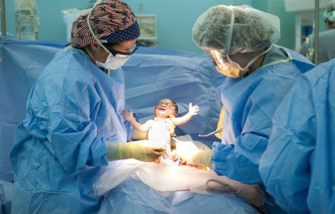 Роды после трансплантации матки