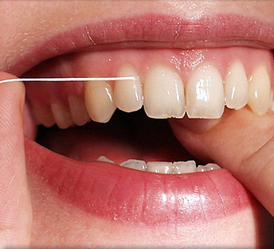Зубная нить может навредить зубам