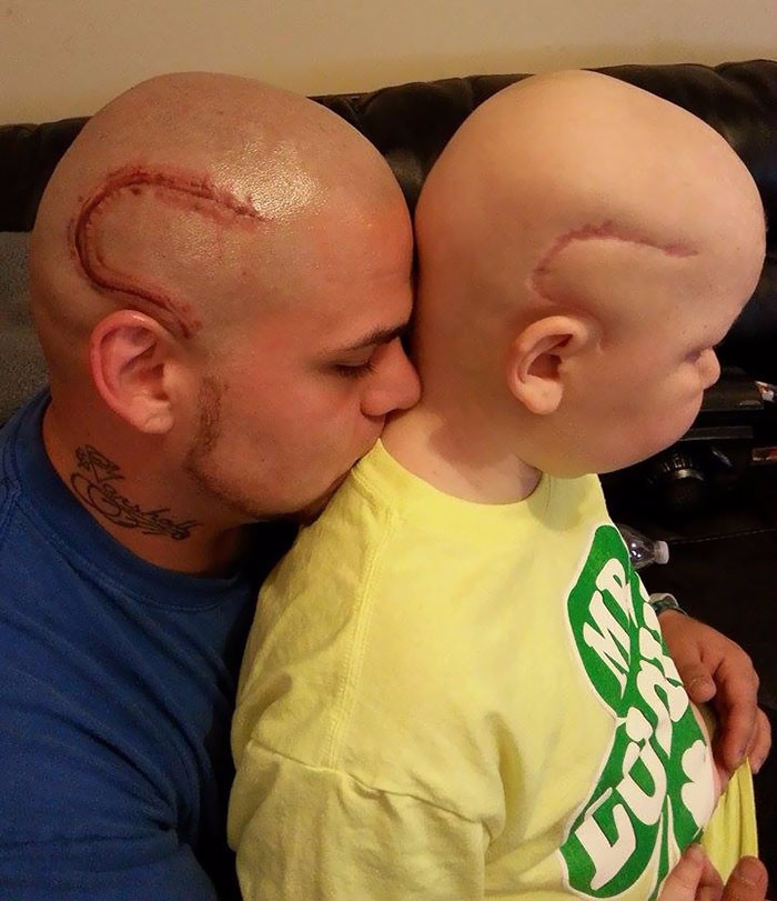 Американец сделал тату в виде шрама на голове у сына