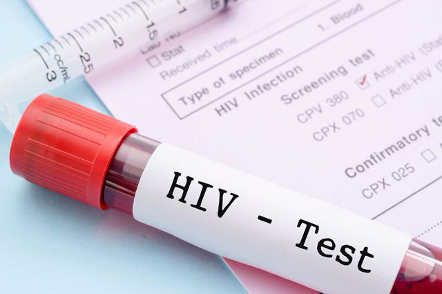 Эксперты против принудительного учёта пациентов с ВИЧ