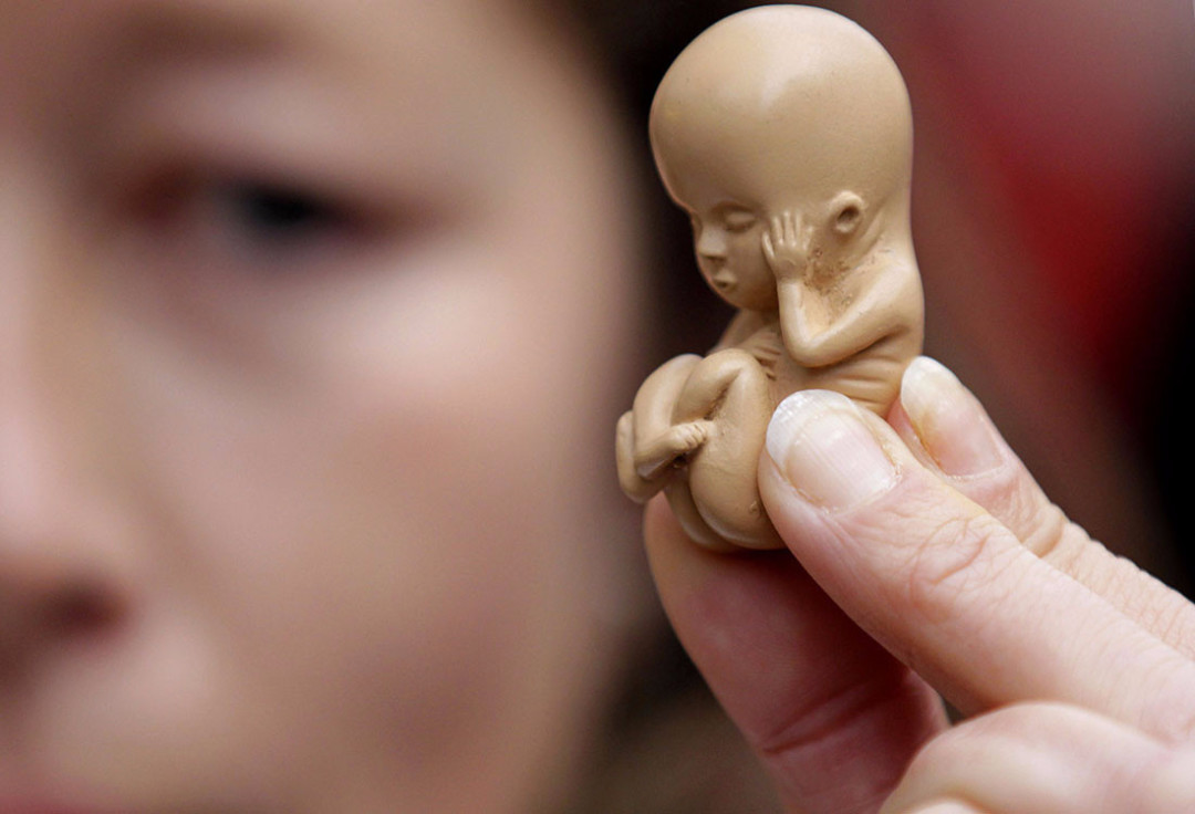 Активисты РПЦ описали механизм ограничения финансирования абортов 