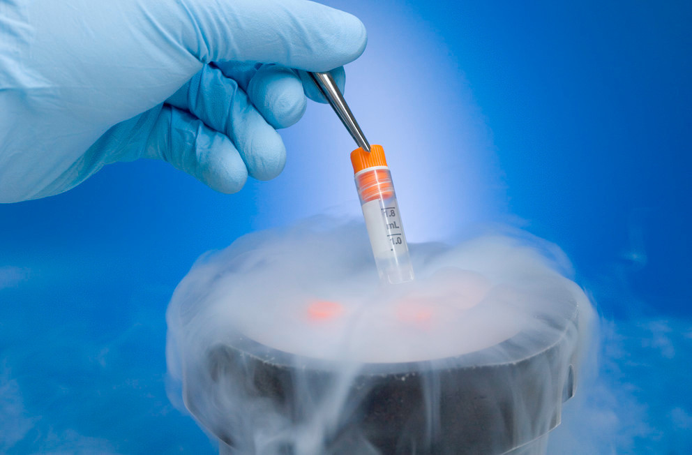Заморозку эмбрионов могут включить в перечень процедур, финансируемых по программе ОМС