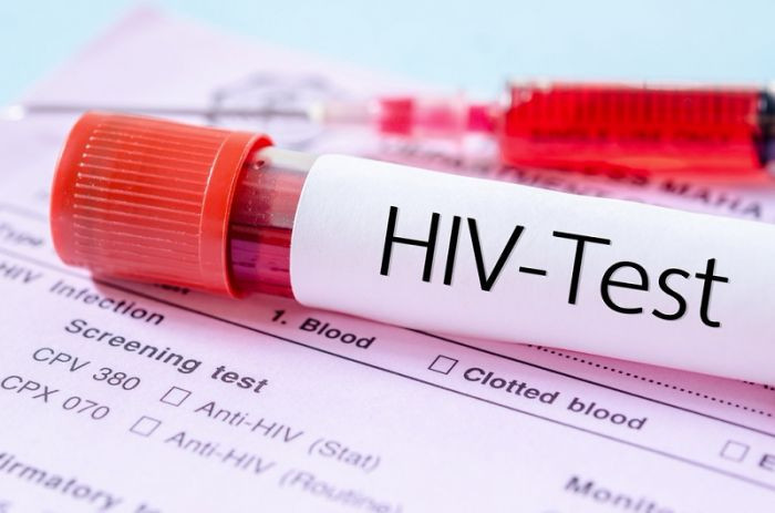 Экспресс-тест на ВИЧ можно купить без рецепта
