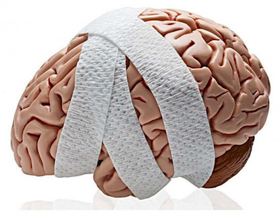В США одобрен новый метод диагностики сотрясения мозга