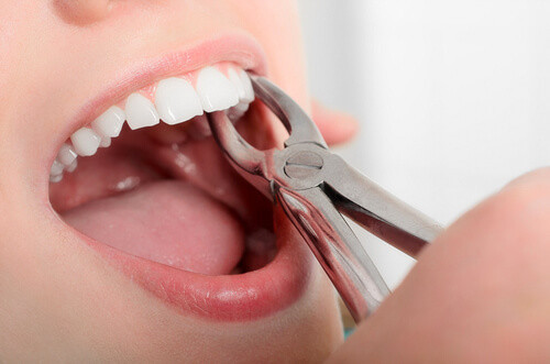 В Петербурге завершено следствие по уголовному делу в отношение врача-стоматолога, удалявшего здоровые зубы