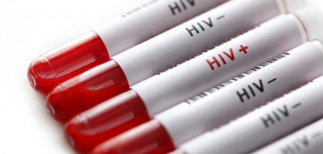 Названы регионы с самой высокой заболеваемостью ВИЧ-инфекцией